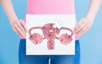Ovarialzysten: Die häufigsten Fragen & Antworten