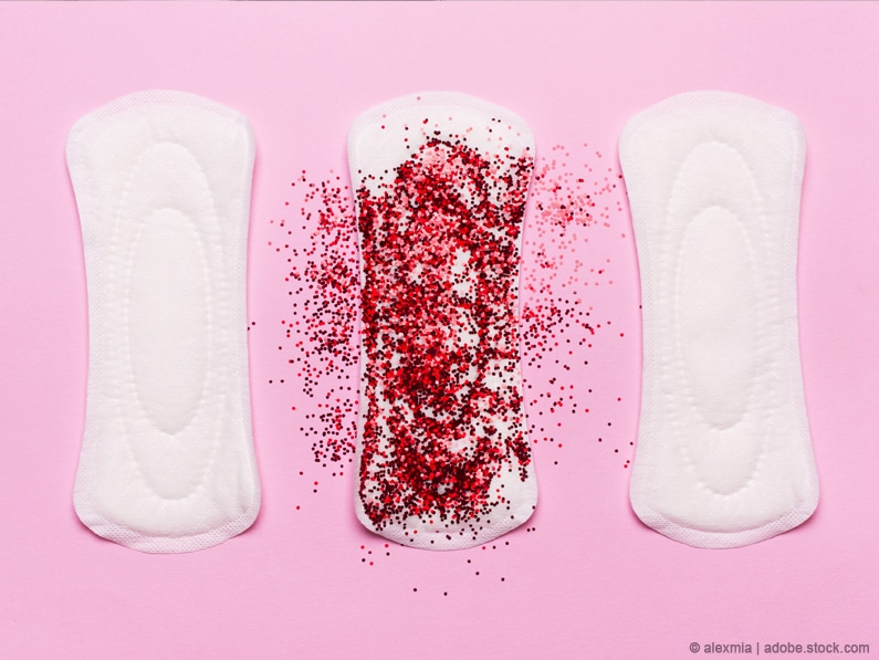 Menstruationsstörungen und Zyklusunregelmäßigkeiten: Alle Störungen kurz erklärt