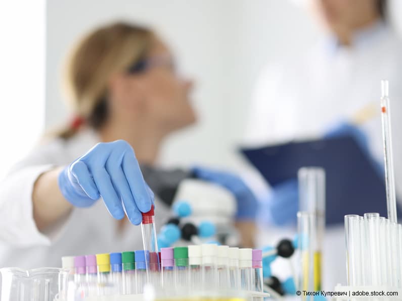 Laborwerte selbst bestimmen: Hormontests und Schilddrüsenwerte