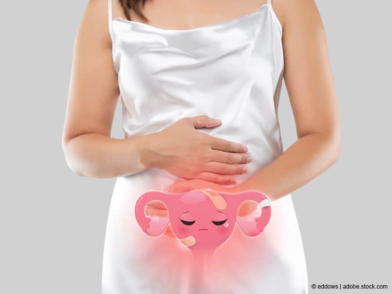 Endometriose: Einziger Ausweg Pille?! Natürliche Behandlung bei Endometriose
